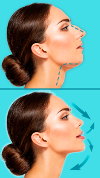 Download Rhinoplasty - Nose Editor Kecantikan untuk Android tangkapan layar 3